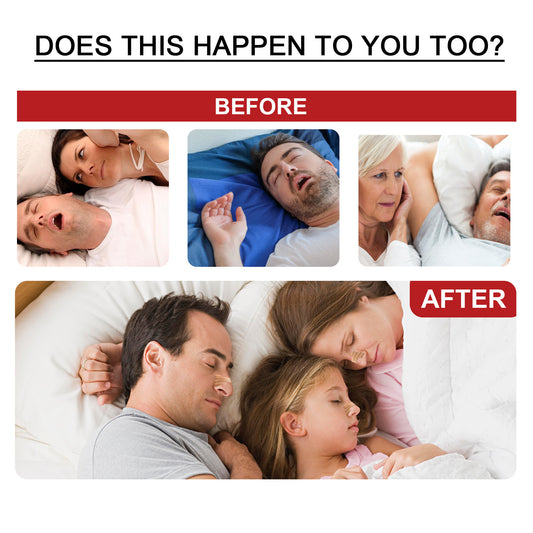 Ελαστικά αυτοκόλλητα κατά του ροχαλητού