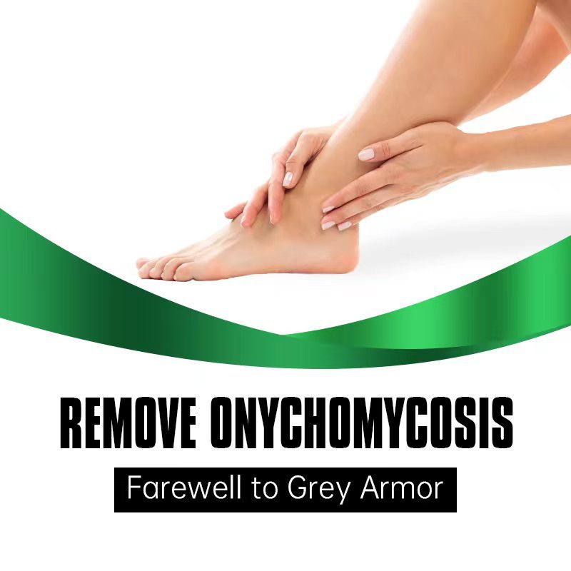 Θεραπεία για αφαίρεση μύκητα νυχιών και φροντίδα ποδιών