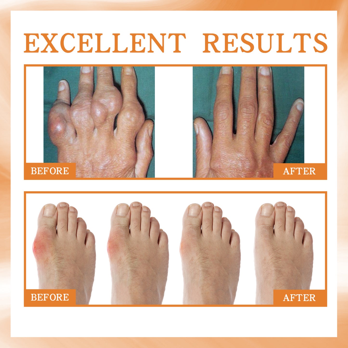 Σπρέι για την ανακούφιση από τον πόνο στις αρθρώσεις